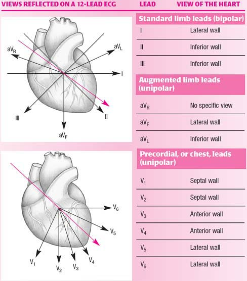 12-lead ECG diagram showing the relationship between electrodes and derived leads