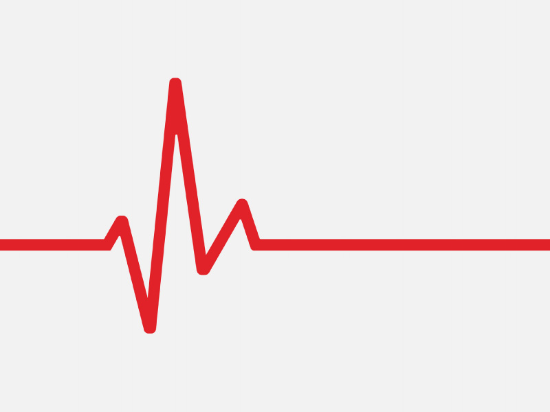 ECG waveform illustration used for 12-lead fundamentals