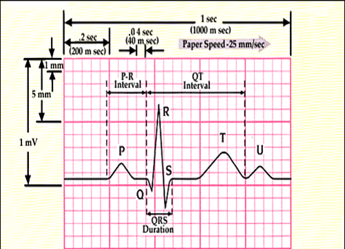 ECG paper grid used for systematic interval and waveform measurement